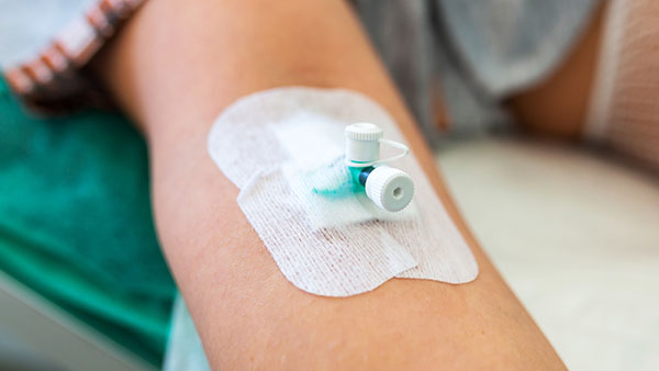 peripheral intravenous cannulation online peripheral intravenous cannulation online